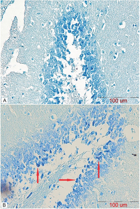 Figure 10 A representative coronal section of the DG area of a mature male rat’s hippocampus stained using Toluidine Blue to observe pre-apoptotic cells in (A) control and (B) stanozolol treated groups. The arrows indicate dark neurons (scalebar=100μm).