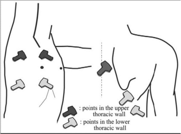 Figure 1 7-point schematic diagram for chest ultrasonography.