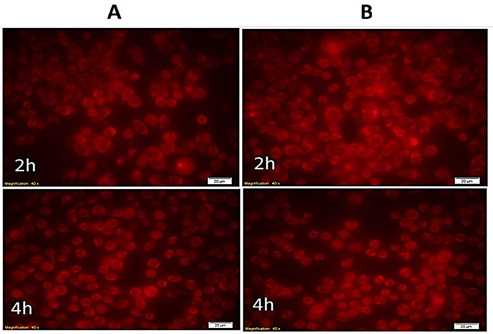 Figure 2 DOX loaded nanocarrier uptake by MCF-7 cells. A. Cells treated with free Rhodamine. B. Cells treated with DOX loaded nanocarrier
