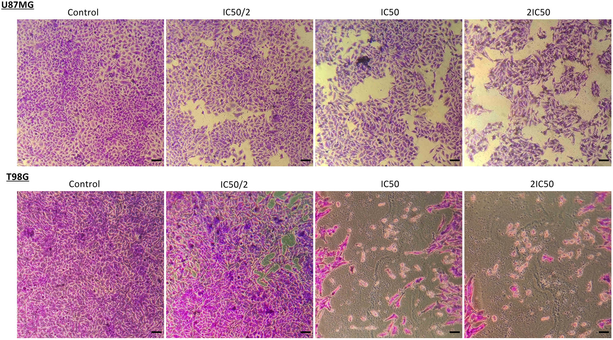 Figure 3
Crystal violet staining (0.2% crystal violet) of U87MG and T98G cells after treatment with TMF in concentrations of IC50/2, IC50, and 2IC50. Cells that survived are represented in purple; images were taken using a phase-contrast microscope in 10× magnification. Scale bars = 100 μM.