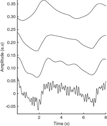 Figure 10 Respiratory components extracted with LPNR and FIR filters from the BCG signal, together with reference signals. From top to bottom: reference signal abdominal effort, BCG component extracted with LPNR and FIR filter and original BCG [16].