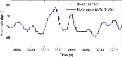 Figure 14 Comparison of in-ear PPG sensor with reference ECG from PSG.