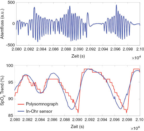 Figure 16 Example in-ear SpO2 measurement (bottom) from sleep laboratory study with PSG reference flow (top) and SpO2 (bottom).