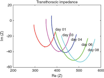 Figure 9 Example BIS measurement from the cardiac recompensation study.