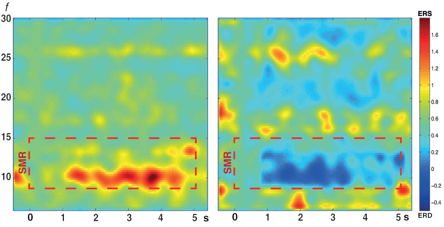 Figure 2 Time-frequency representation (TFR) of rest trials (left panel) and task trials (right panel) in a representative participant. Sensorimotor rhythm (SMR, 8–15 Hz) event-related desynchronization (ERD, dark blue) was detectable shortly after onset of the task (0 s) and translated into grasping motions of a hand exoskeleton. Grasping motions were initiated if the ERD detection threshold was exceeded within a sample block of 100 ms. A full closing motions was reached if ERD were detected in 43 successive sample blocks.