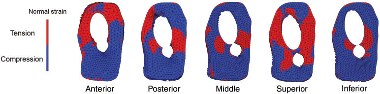 Figure 3: Diagram showing the normal strain distribution in fracture surface for five different blade positions.