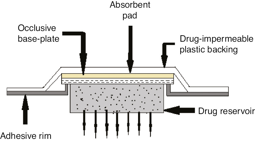Figure 3: Matrix dispersion system.