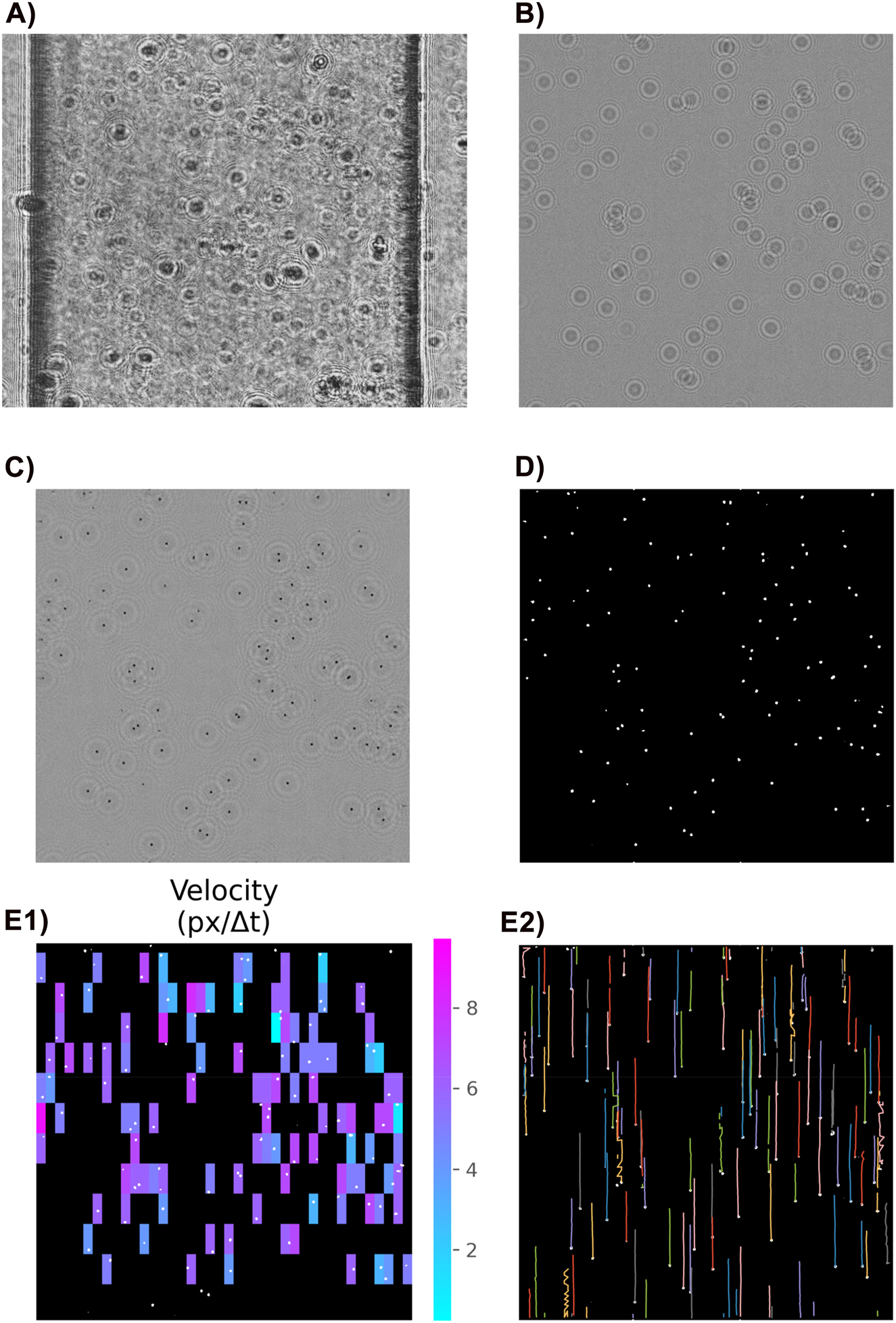 Figure 7:
An example of a video frame after being processed by each module of the analysis tool. For visualization purposes, just a piece (800 × 800 pixel) of a frame is shown here. The real frame is larger (800 × 2,184 pixel). The modules are: A) Conversion to gray-scale, B) crop and background subtraction, C) holographic reconstruction, D) particles segmentation, E1) PIV. Due to the particle sparsity, it is not possible to calculate the velocity for all image patches. Those appear black in the image, E2) PTV. Some trajectories contain zigzags. This may happen when two particles move side-by-side very close to each other. In this situation, the algorithm may fail to differentiate them. Fortunately, this has no strong impact on the final flow rate calculation, because it is relatively rare, and it has minimum effect on the velocity aligned with the flow direction, which is the information that is used to calculate the flow rate.