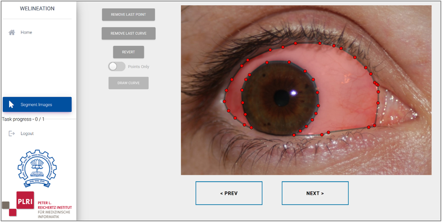 Figure 4:
Segmentation tool.