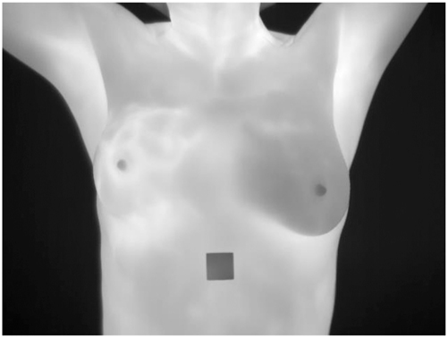 Figure 2: 
Cancerous image.
