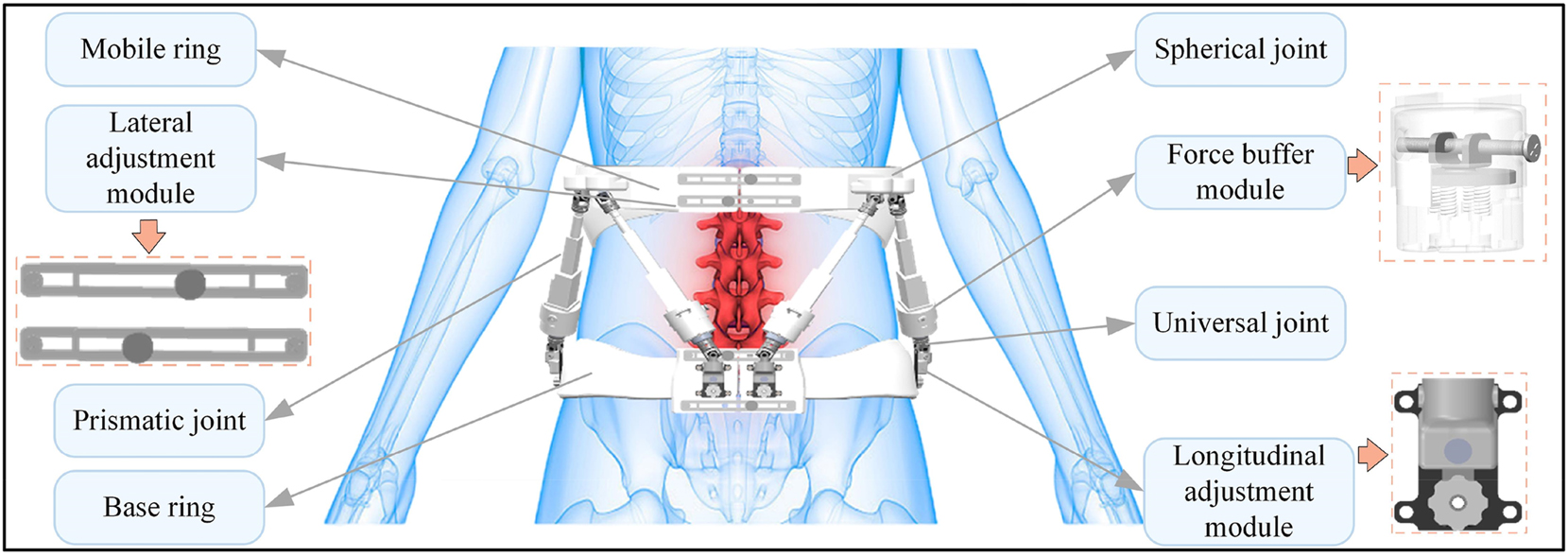 Figure 1:
Proposed design of powered lumbar exoskeleton.