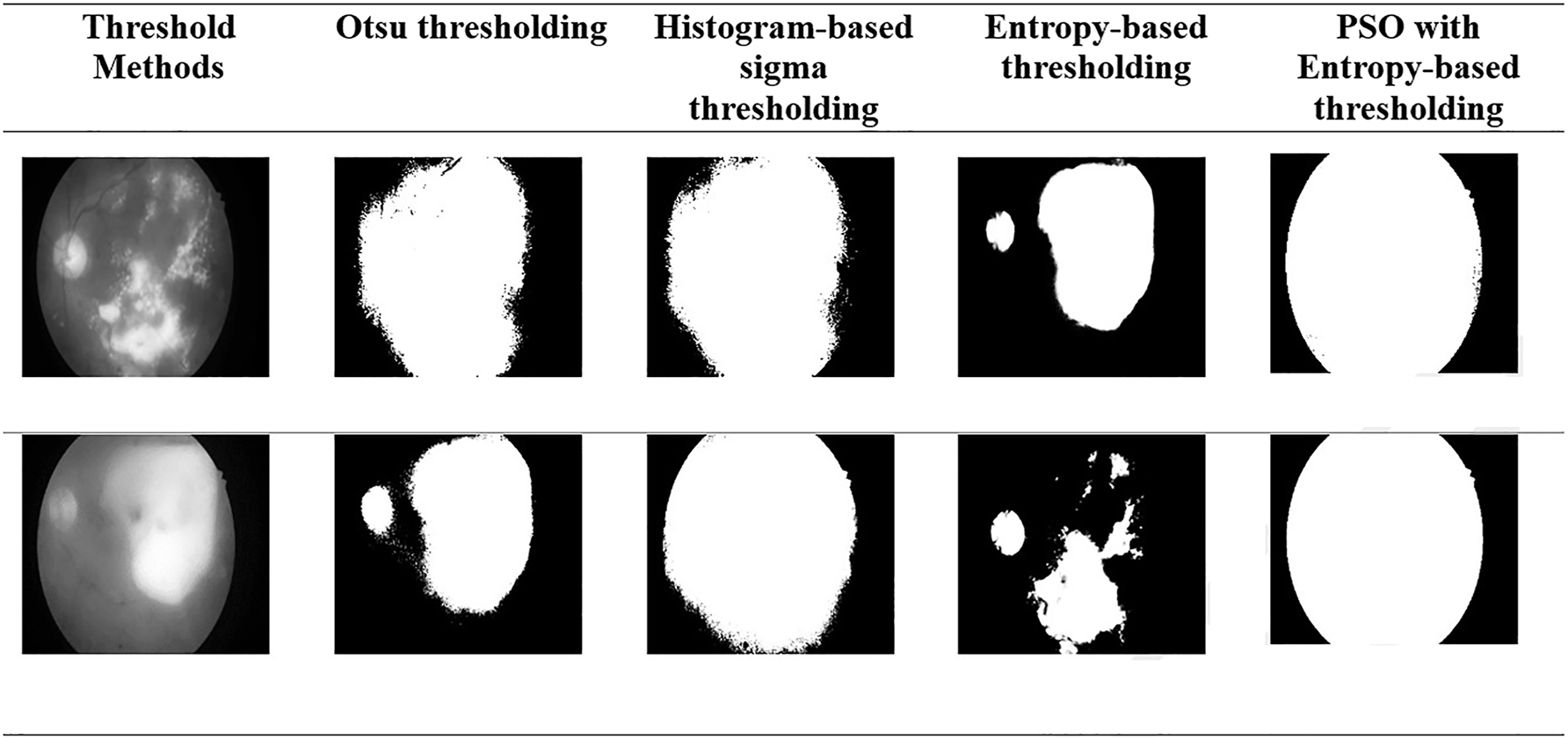 Figure 3:
Comparative performance of the thresholding with various methods.