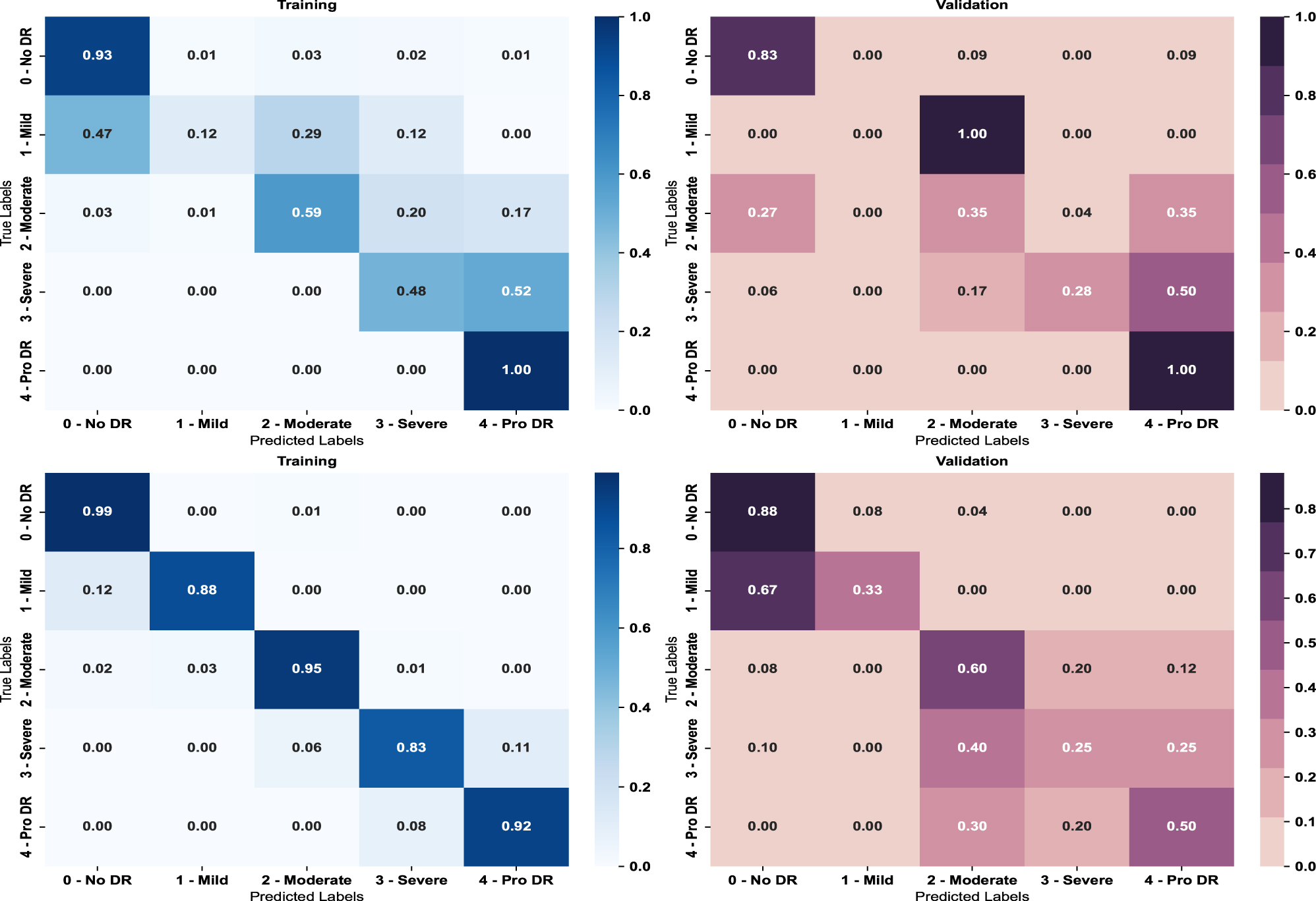 Figure 4:
Result of multi-class confusion matrix on (top) non-segmented images (bottom) segmented images.