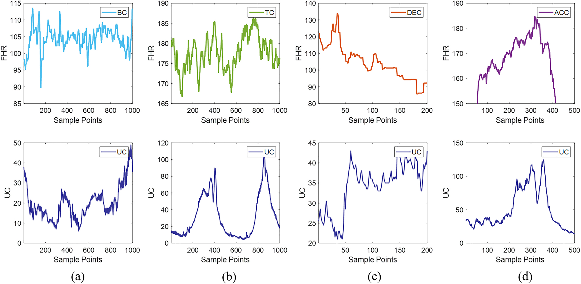 Figure 2: 
The four types of specific data within a segment of FHR signals. (a) Shows a bradycardia event, (b) shows a tachycardia event, (c) depicts a deceleration event, and (d) displays an acceleration event. The top part represents FHR, and the bottom part represents UC.
