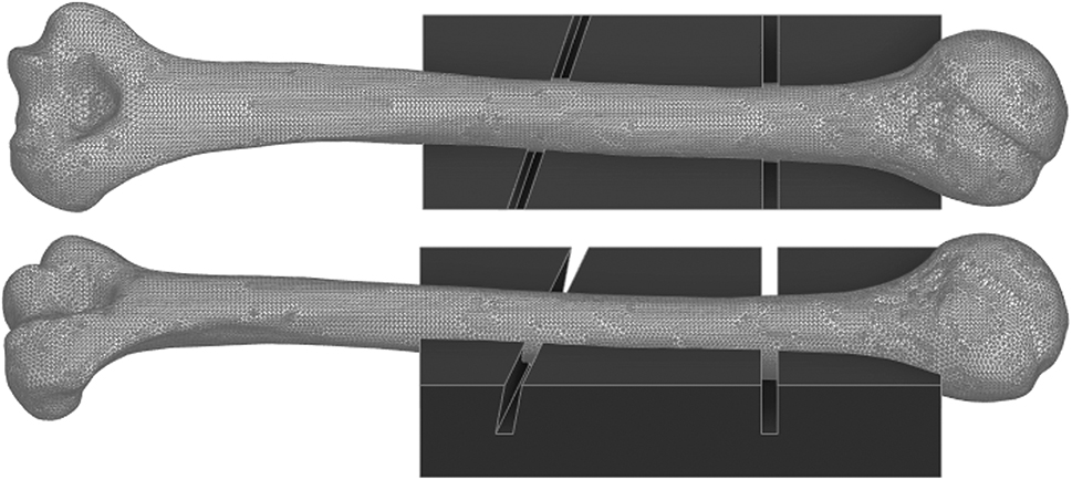 Figure 1: 
Computational 3D model of the Synbone® humerus type 5010 and a custom saw jig that adapts to the bone in a single position only, that acts as a cutting guide to perform a consistent osteotomy (AO12C2) for all samples.
