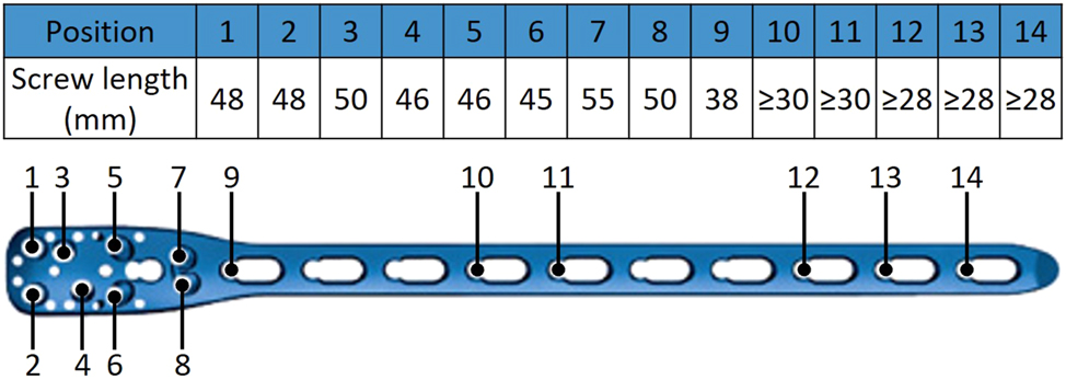 Figure 2: 
Screw configuration of the implant system PHILOS® long 10-holes used identically for both sample groups.
