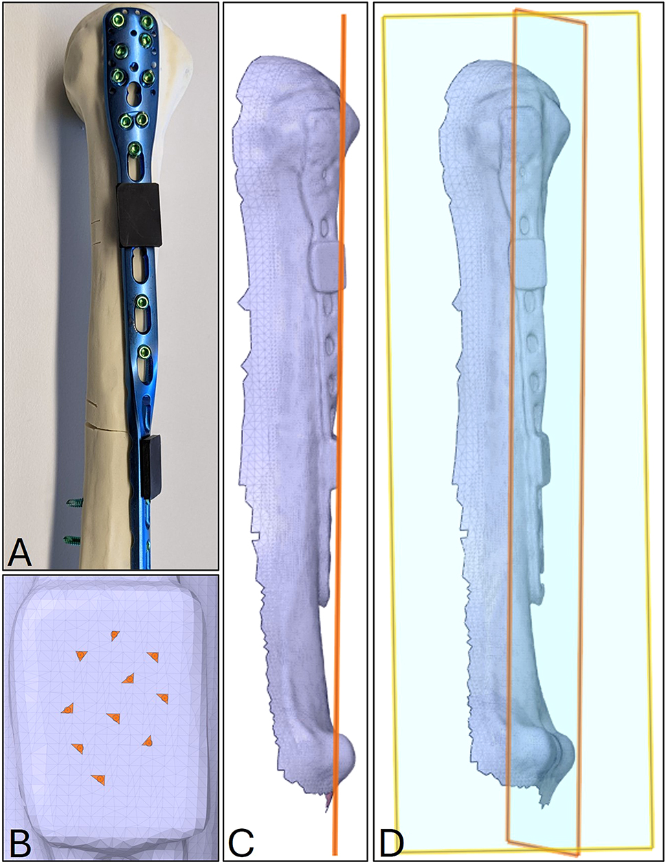 Figure 3: 
Procedure to determine the torsional angle of the helical plates via 3D scanning. (A) Helical test sample with two 3D printed adapters (black components) clipped into unused screw holes above and below the deformed section of the bone plate; (B) selection of 10 triangular faces of the tessellated flat surface of the lower adapter of the digitalized sample (C) virtual plane of the lower adapter based on the 10 triangular faces; (D) visualization of the two skew planes in 3D space, describing the torsion angle by their angle to one another.
