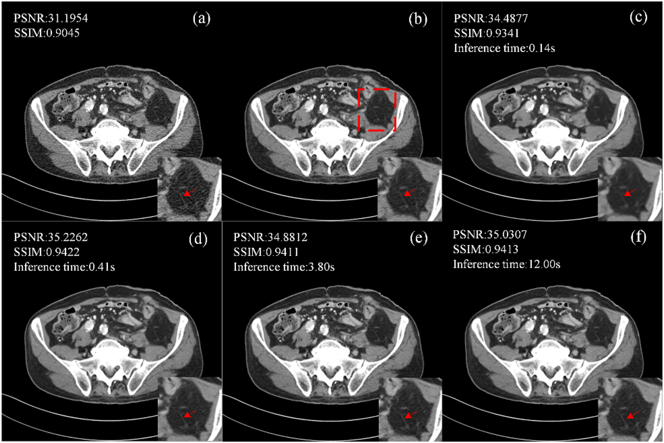Figure 6: 
Ablation studies of CECDM with different T settings (a) LDCT, (b) NDCT, (c) T=1, (d) T=10, (e) T=50, (f) T=200.
