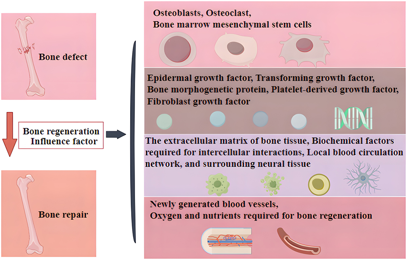 Figure 1: 
The main factors affecting bone regeneration.
