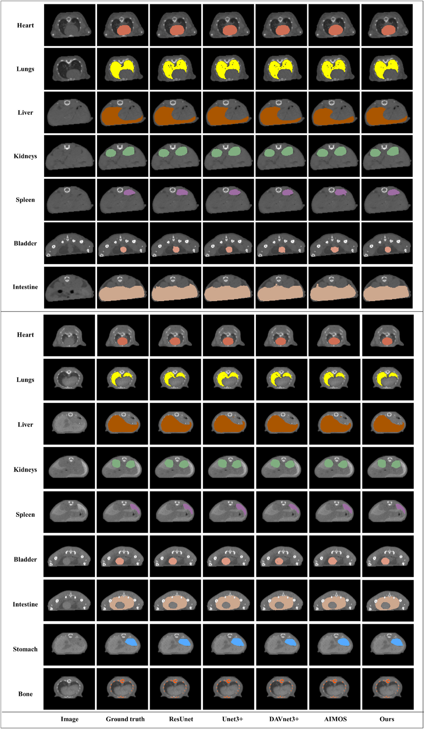 Figure 2:
Segmentation results of the five networks for the native dataset (UP) and the contrast-enhanced dataset (Down).