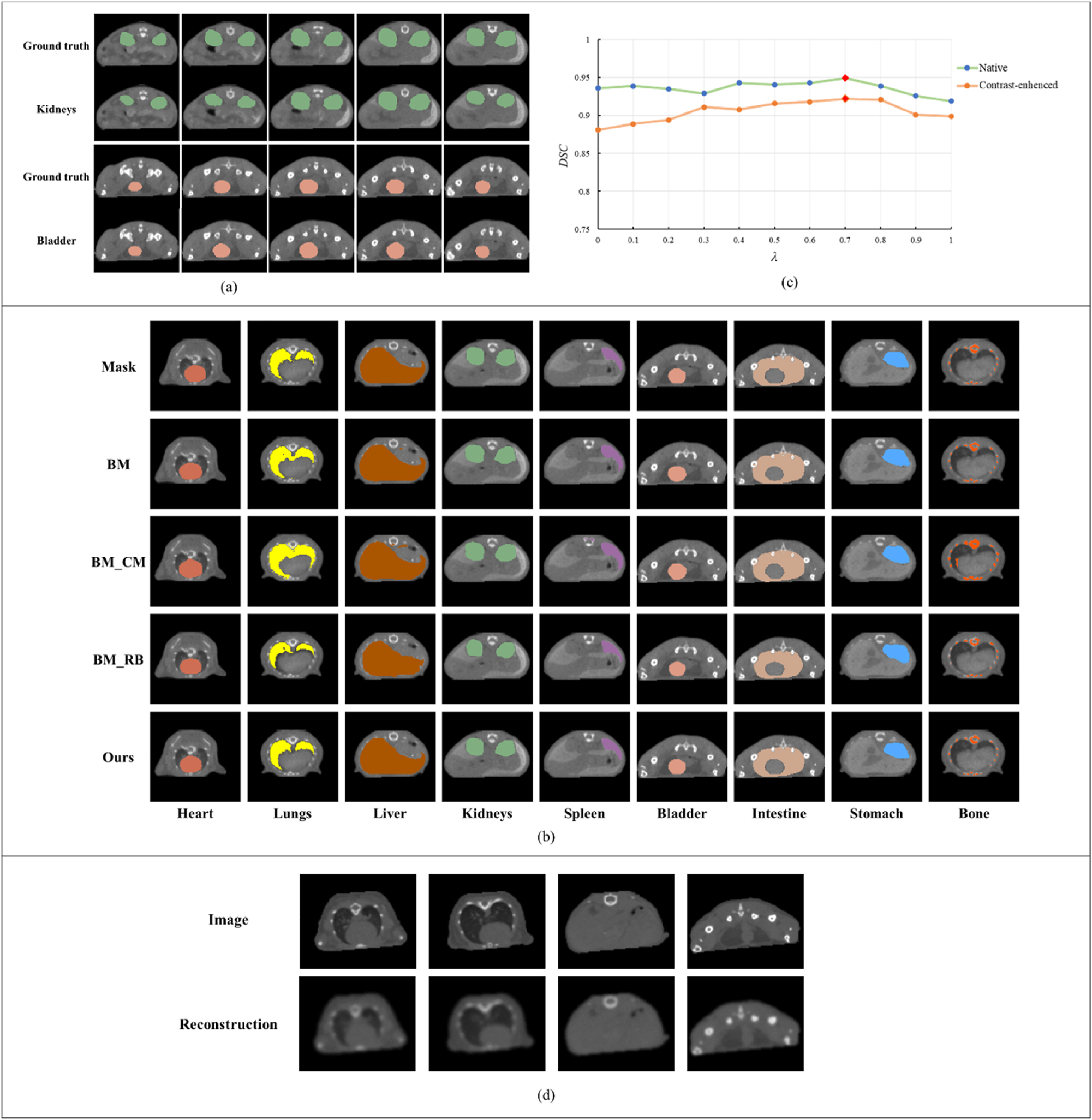 Figure 4:
The results of different experiments. (a) The results of kidneys and bladder. (b) Visual results of ablation study. (c) The results under different λ values. (d) The result of the reconstruction decoder.
