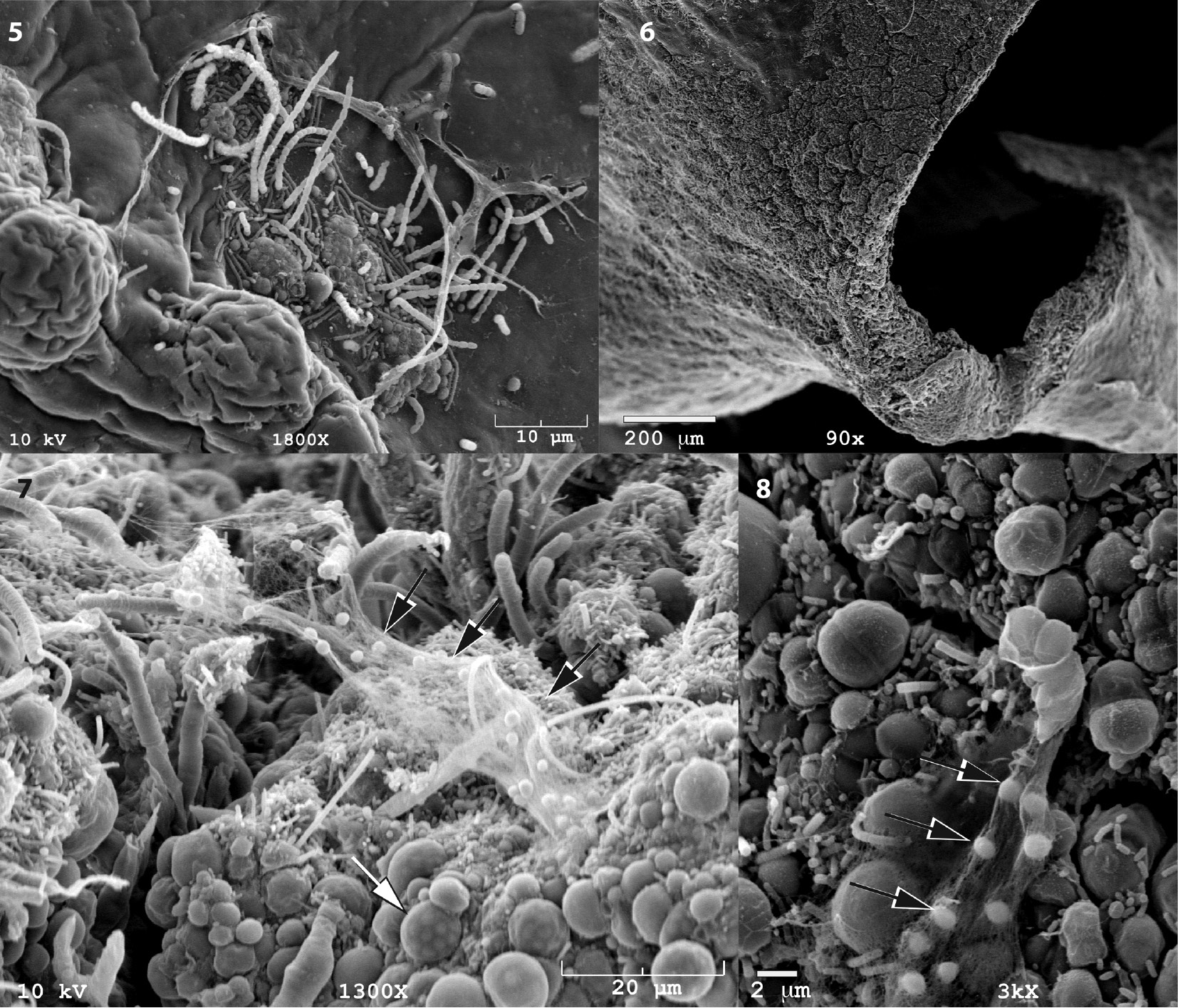 Figures 5–8: Microbial colonisation of holdfast regions of wild blades.(5) A peeling area of mucilage and/or biofilm shows the intimate association of bacteria within mucilage on a flat surface adjacent to the holdfast, and most of the bacteria are rod-shaped or filamentous. Communities surrounding the holdfast disc contain dense, often encrusting, masses of epiphytic bacteria, but become patchier towards the centre of the blade (Figure 6). (7–8) At higher magnification of the area shown in Figure 6, microbial community diversity is apparent, and it includes bacteria that are structurally similar to some of the baeocyte-producing pleurocapsalean cyanobacteria. White arrow in Figure 7 shows an intact individual, and black arrows in Figures 7 and 8 indicate possible baeocyte/endospore release and mucilage trails from epiphytes on two different wild plants.