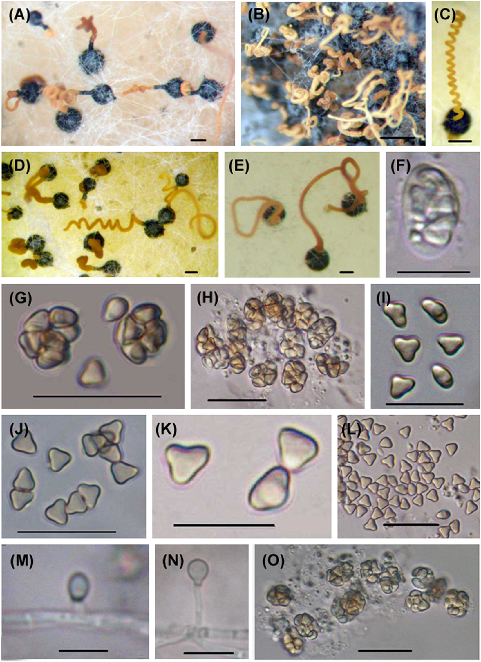 Figure 1: 

Microascus trigonosporus. (A–E) Perithecia with spore cirrus. (F) Young ascus. (G, H, O) Mature asci. (I–L) Ascospores. (M, N) Anamorphic Scopulariopsis trigonosporus of Microascus trigonosporus. Scale bars: (A–E) = 100 μm, (G, H, O) = 20 μm, (F, I–N) = 10 μm.
