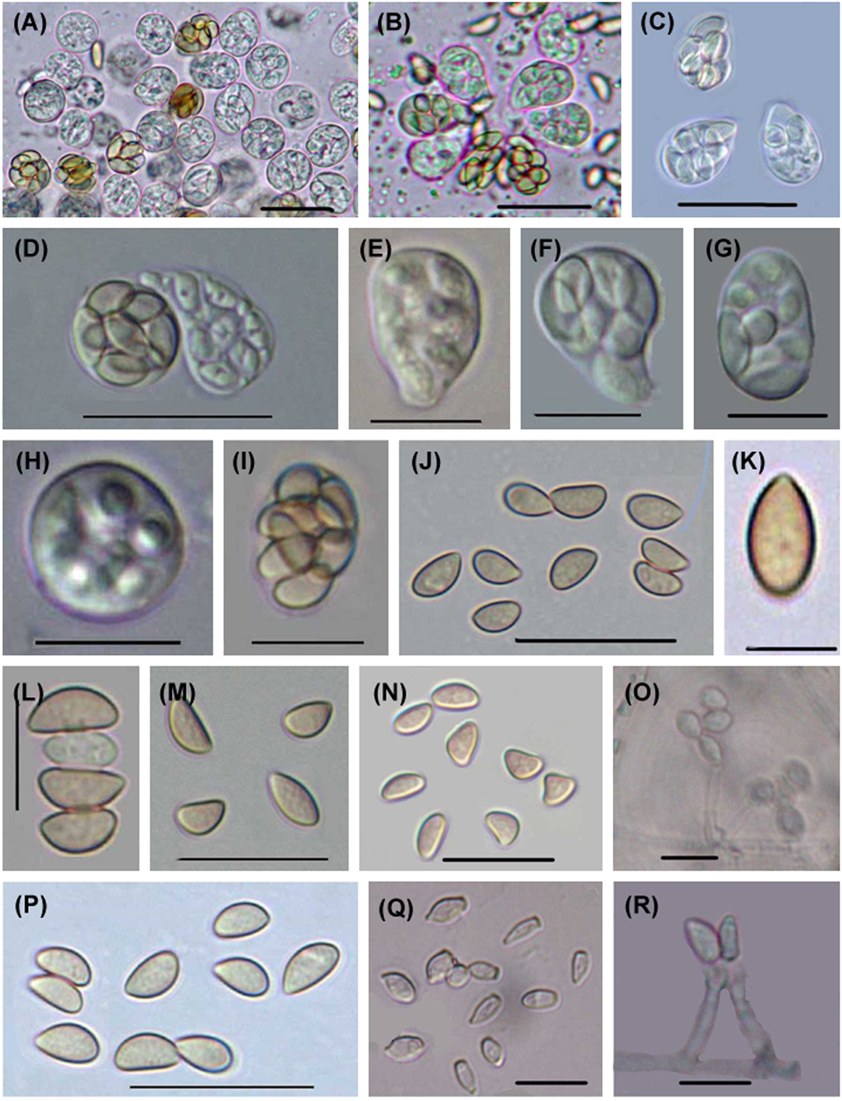 Figure 2: 

Microascus cinereus. (A–I) Asci. (J–N, P) Ascospores. (O, Q, R) Anamorphic Scopulariopsis cinerea of Microascus cinereus. Scale bars: (A–D, K, M, P–Q) = 20 μm, (E–J, L, N–O, R) = 10 μm.
