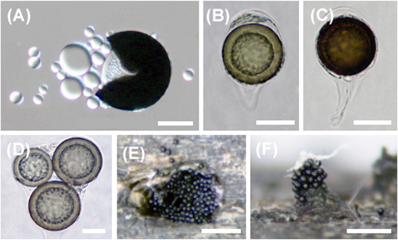 Figure 4: 

Monosporascus cannonballus. (A) Oil globules realised from squashed ascospore. (B) Ascus with single globose ascospore. (C) Thick-walled ascospore. (D) Ascus with three globose ascospores. (E, F) Released ascospores around the projecting neck of the ascoma. Scale bars: (A–D) = 20 μm, (E–F) = 300 μm.
