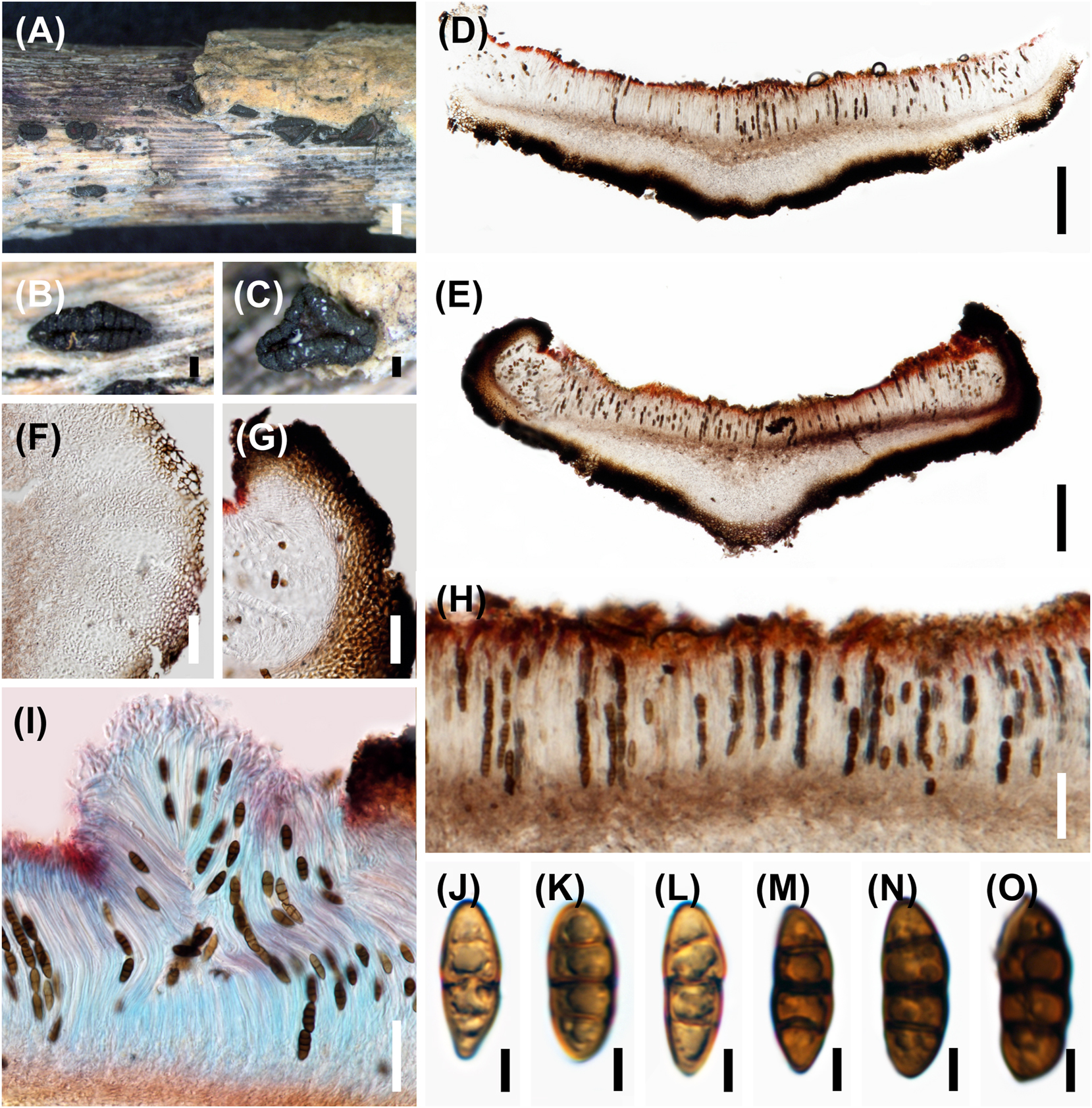 Figure 7: 

Rhytidhysteron bruguierae. (A–C) Appearance of hysterothecia on host. (D, E) Vertical section through hysteriothecium. (F, G) Cells of peridium. (H, I) Pseudoparaphyses, asci, and ascospores. (I) Stained with lactophenol cotton blue. (J–O) Ascospores. Scale bars: (A) = 1 mm, (B–E) = 200 μm, (F–I) = 50 μm, (J–O) = 5 μm.
