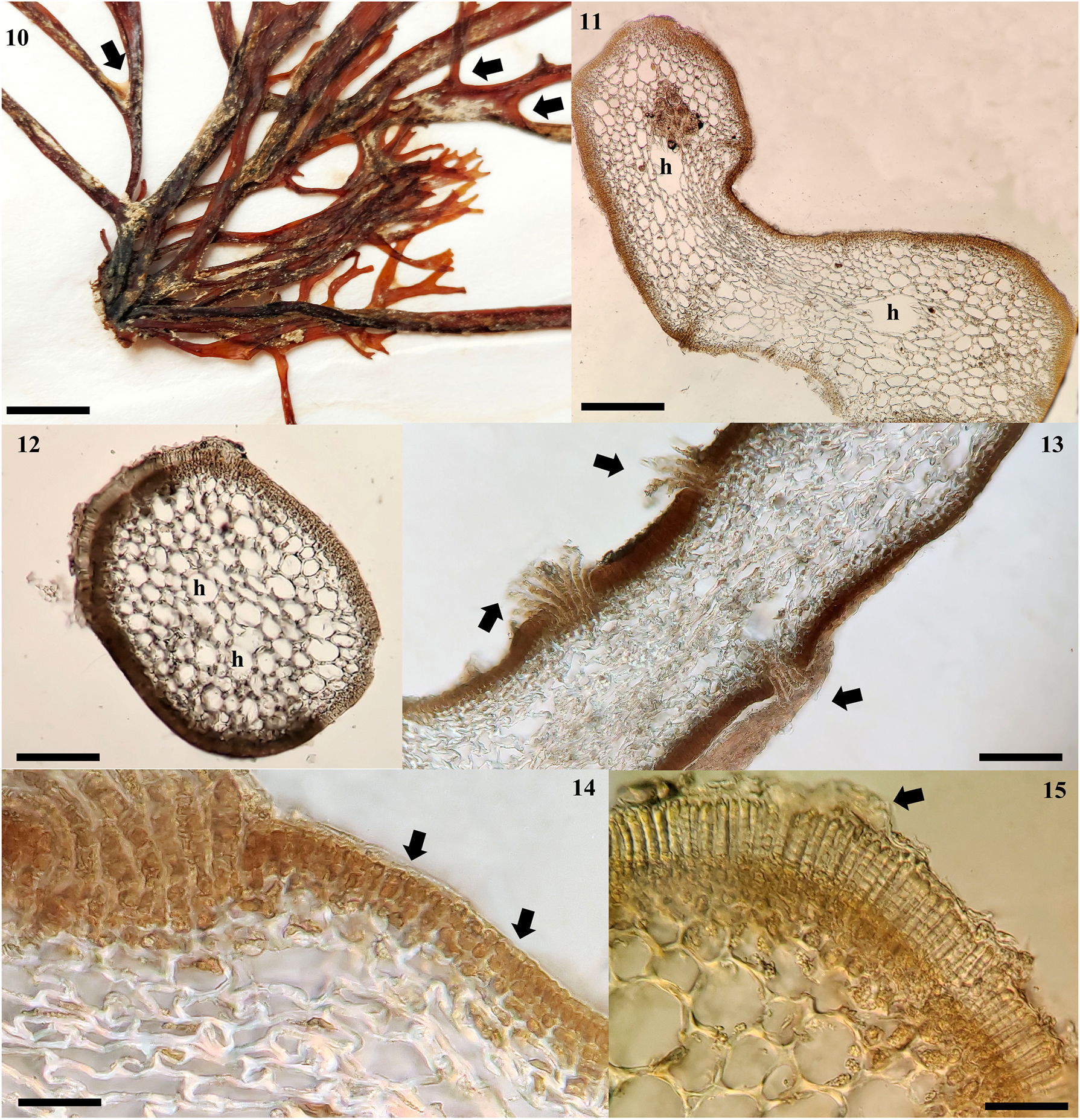 Figures 10−15: 
Chnoospora minima. (10) UAMIZ-1517. Specimen from Villa Rica, Veracruz showing a consolidated holdfast. Scale bar = 4 mm. (11) UAMIZ-1518. Cross section through middle part of an erect axis with compressed form showing medullary cells and hollows (h) between them. Scale bar = 150 μm. (12) UAMIZ-23. Cross section through middle part of an erect axis with cylindrical form showing medullary cells with hollows (h) between them. Scale bar = 150 μm. (13) UAMIZ-1517. Cross section of an erect axis showing cortical cryptostomata with numerous long hairs (arrows). Scale bar = 150 μm. (14) UAMIZ-1520. Cross section of an erect axis showing three layers of cortical cells (arrows). Scale bar = 40 μm. (15) UAMIZ-46. Cross section showing uniseriate plurangia covered with a loosened cuticle (arrow). Scale bar = 70 µm.
