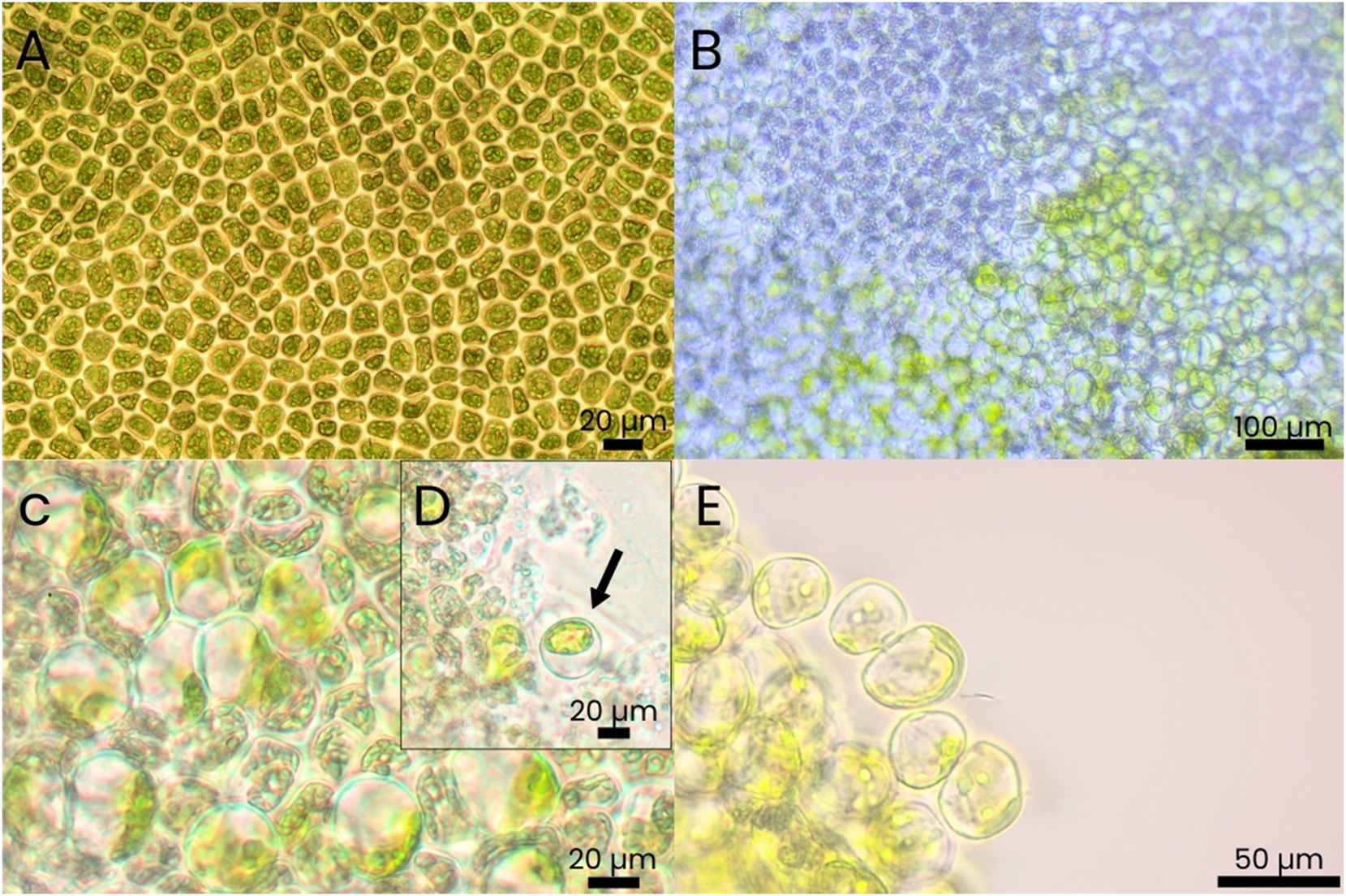 Figure 4: 
Microscopic observations of thalli of Ulva lacinulata going through the degradation process [(A and B) show different pieces of Ulva]. (A) Surface view and typical cellular structure of a healthy vegetative NE-Atlantic U. lacinulata thallus. (B) Cell type heterogeneity during degradation (pale cells mixed with green cells). (C) Heterogeneity of cell types within the thalli. Large spherical green cells with one parietal chloroplast and single pyrenoids are visible between much smaller pale green cells containing a dense accumulation of grana. (D) Spherical cell detaching from the thallus (arrow). (E) Protoplast-like cells with parietal chloroplast detaching from the main Ulva thallus.
