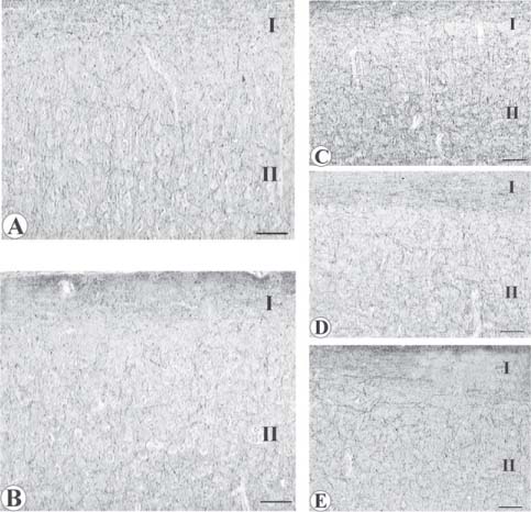 Figure 1 Sections of rat frontal cortex processed for neurofilament 200 kDa immunohistochemistry.(A) Control normotensive Wistar Kyoto (WKY) rat; (B) control untreated spontaneously hypertensive rats (SHR); (C) SHR treated with galantamine; (D) SHR treated with choline alphoscerate; (E) SHR treated with galantamine and choline alphoscerate in association. Neurofilament 200 kDa immunoreactive axons in the neuropil of frontal cortex were remarkably decreased in SHR. The loss of neurofilament 200 kDa immunoreactive axons was countered by treatment with galantamine and galantamine plus choline alphoscerate. Choline alphoscerate alone was less active but was more active than galantamine by itself. Roman numerals indicate the cerebrocortical zones shown. Calibration bar: 50 μm. Adapted from [69].