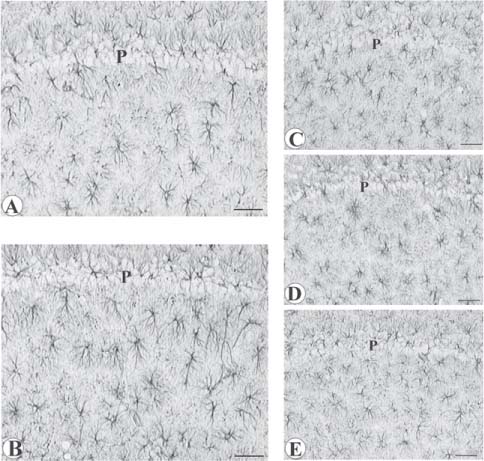 Figure 2 Sections of the CA1 subfield of hippocampus processed for glial fibrillary acidic protein (GFAP) immunohistochemistry to stain astrocytes.(A) Control normotensive WKY rat; (B) control untreated SHR; (C) SHR treated with galantamine; (D) SHR treated with choline alphoscerate; (E) SHR treated with galantamine plus choline alphoscerate. Note in SHR the numerical and size increase of GFAP-immunoreactive astrocytes. This phenomenon was countered by treatment with choline alphoscerate and with galantamine plus choline alphoscerate but not with treatment with galantamine alone. P, pyramidal neurons. Calibration bar: 50 μm. Adapted from [70].
