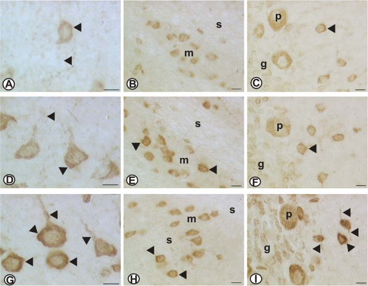 Figure 3 Micrographs of VAChT immunoreactivity in different cerebral areas investigated (A, D, G) frontal cortex; (B, E, H) striatum; (C, F, I) cerebellum.Note varicosities (puntactes of immunostaining) surrounding cerebrocortical (A, D and G) and Purkinje neuron (C, F and I) cell bodies (arrowheads). In the striatum VAChT immunoreactive neurons were observed in the matrix. Treatment with CDP-choline (D, E, and F) and to a greater extent with choline alphoscerate (G, H and I) increased VAChT immunoreactivity compared to control rats (A, B and C). g, granular layer of cerebellar cortex; m, matrix; p, Purkinje neurons; s, striosome. Calibration bar: 10 μm. Adapted from [69].