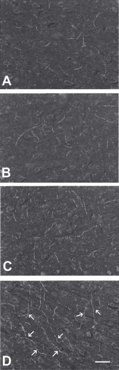 Figure 4 Dark-field sections of layer V of area 4 of frontal cortex. Acetylcholine immunohistochemistry.(A) Control rat; (B) rat treated for 1 week with 150 mg/kg/day choline alphoscerate; (C) rat treated for 1 week with 2.5 mg/kg/day rivastigmine; (D) rat treated for 1 week with 150 mg/kg/day choline alphoscerate plus 2.5 mg/kg/day rivastigmine; (E) section next to that shown in A exposed to a pre-adsorbed acetylcholine antibody to verify the specificity of immune reaction. Note the localization of immune staining in nerve fiber-like structures and the increased intensity of immunostaining induced by treatment with choline alphoscerate or rivastigmine. A further increase of immunoreactivity was found in the rivastigmine plus choline-alphoscerate-treated rats (arrows). Calibration bar: 70 μm. Adapted from [66].