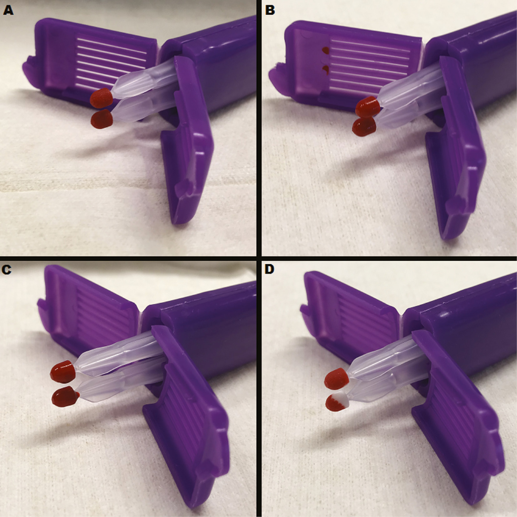 Figure 1: 
Different types of quality in 20 μL volumetric absorptive microsampling (VAMS) samples.
(A) Sufficient quality VAMS sample meeting all requirements. (B) Insufficient quality VAMS sample because the containers’ cap touched the tip, blood is visible on the inside of the cap. (C) Insufficient quality VAMS sample because of oversaturation, blood is visible on the tip holder. (D) Insufficient quality VAMS sample due to undersaturation, the tip is not completely filled with blood.

