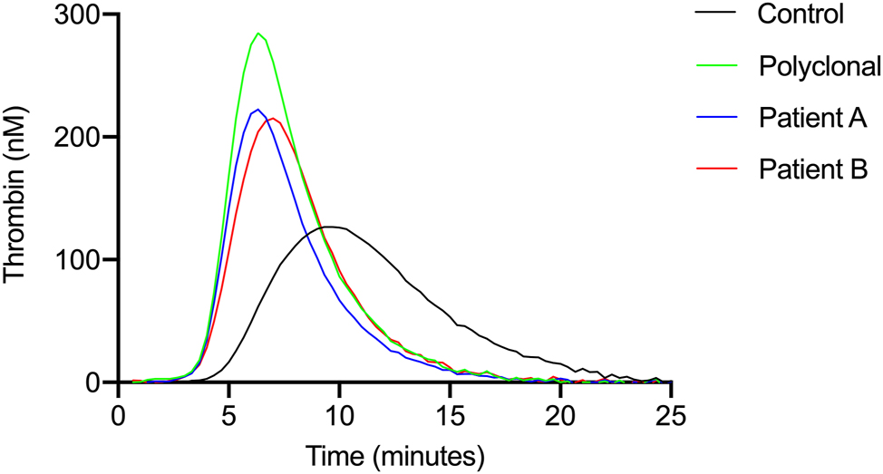 Figure 2: 
Thrombin generation curves upon addition of isolated immunoglobulins the thrombin generation curves show the attenuation of thrombin generation after the isolated paraproteins were added to control platelet-poor plasma at a final concentration of 30 g/L.
