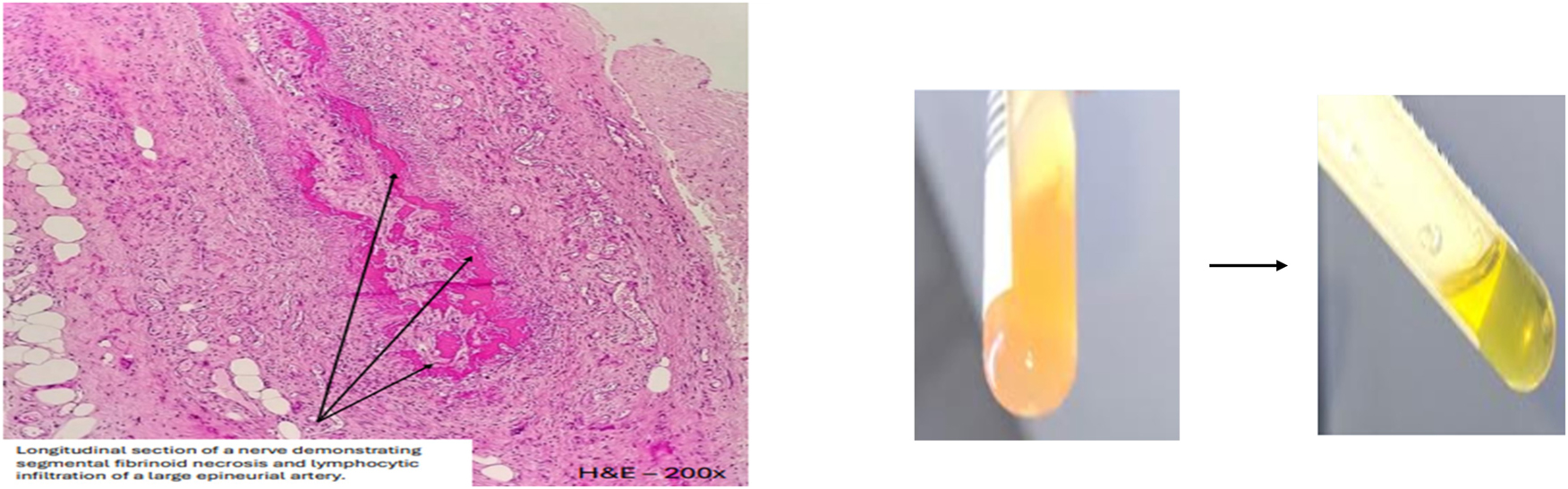 Teaser image from the article