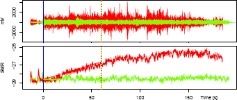 Figure 2 The top panel shows exemplary sEMG recordings from the 20% MVC load case (green) and the 60% MVC load case (red). The corresponding fatigue signals (spectral moment ratio) are displayed below. The vertical lines indicate the beginning and ending of the first 60 seconds considered for evaluation.
