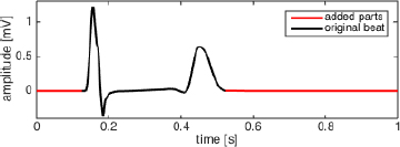 Figure 1 An extended simulated beat showing its ST segment at approximately 0 mV.