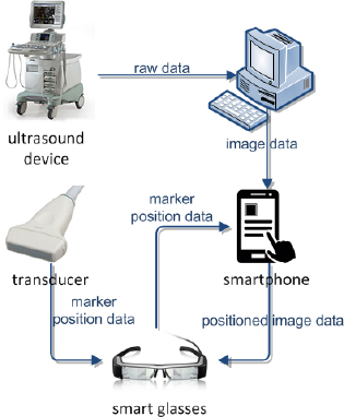 Figure 1 Augmented reality ultrasound data flow.