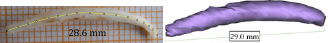 Figure 3 Length measurements.
