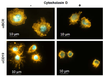 Figure 1 Different cell spreading behavior of LPS activated B cells treated with (right) or without (left) Cytochalasin D on immobilized antibodies BCR or CD19. )). Immunofluorescent staining was performed for F-Actin (Phalloidin-Rhodamin) and DNA (DAPI).
