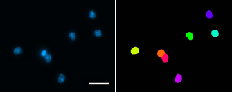 Figure 4 Exemplary segmentation result for nuclei: part of original DAPI image (left); segmentation result (right); scale bar corresponds to 20 μm.