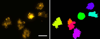 Figure 5 Exemplary segmentation result for F-actin cytoskeleton: brightness adapted part of original Phalloidin-Rhodamin image (left); segmentation result (right); scale bar corresponds to 20 μm.
