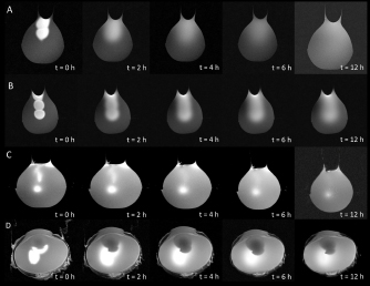 Figure 2 Distribution of GadoSpin™ M (A), GadoSpin™ D (B), GadoSpin™ P (C) in the vitreous model (100 % polyacrylamide-gel) and GadoSpin™ P in porcine vitreous body (D). Depending on the molecular weight the initial wavy injection tracks diffuses up to peripheral area of the vitreous model (A, B). Injecting macromolecular solution (C, D) the initial spot stays in effect for 12 h.