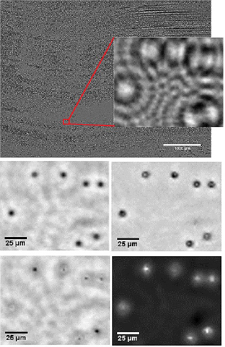 Figure 3 Hologram of blood smear (top), amplitude image after reconstruction of the red marked area without phase retrieval algorithm (middle row left), with phase retrieval algorithm (middle row right), phase image without phase retrieval algorithm (bottom left) and with phase retrieval algorithm (bottom right).