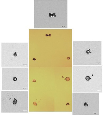 Figure 5 Light microscope image of diatoms (middle), individual identified diatoms with our system all round.