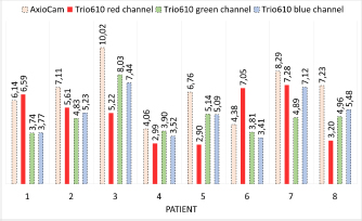 Figure 2 SNR comparison of activity maps calculated from both cameras. ~X, Q1, Q3: AxioCam MRm: 6.9, 5.7, 7.5; Trio 610 green channel: 4.9, 3.9, 5.0; Trio 610 blue channel: 5.2, 3.7, 5.9; Trio 610 red channel: 5.4, 3.15, 6.7.